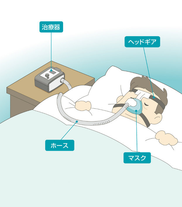 CPAP（シーパップ）-1